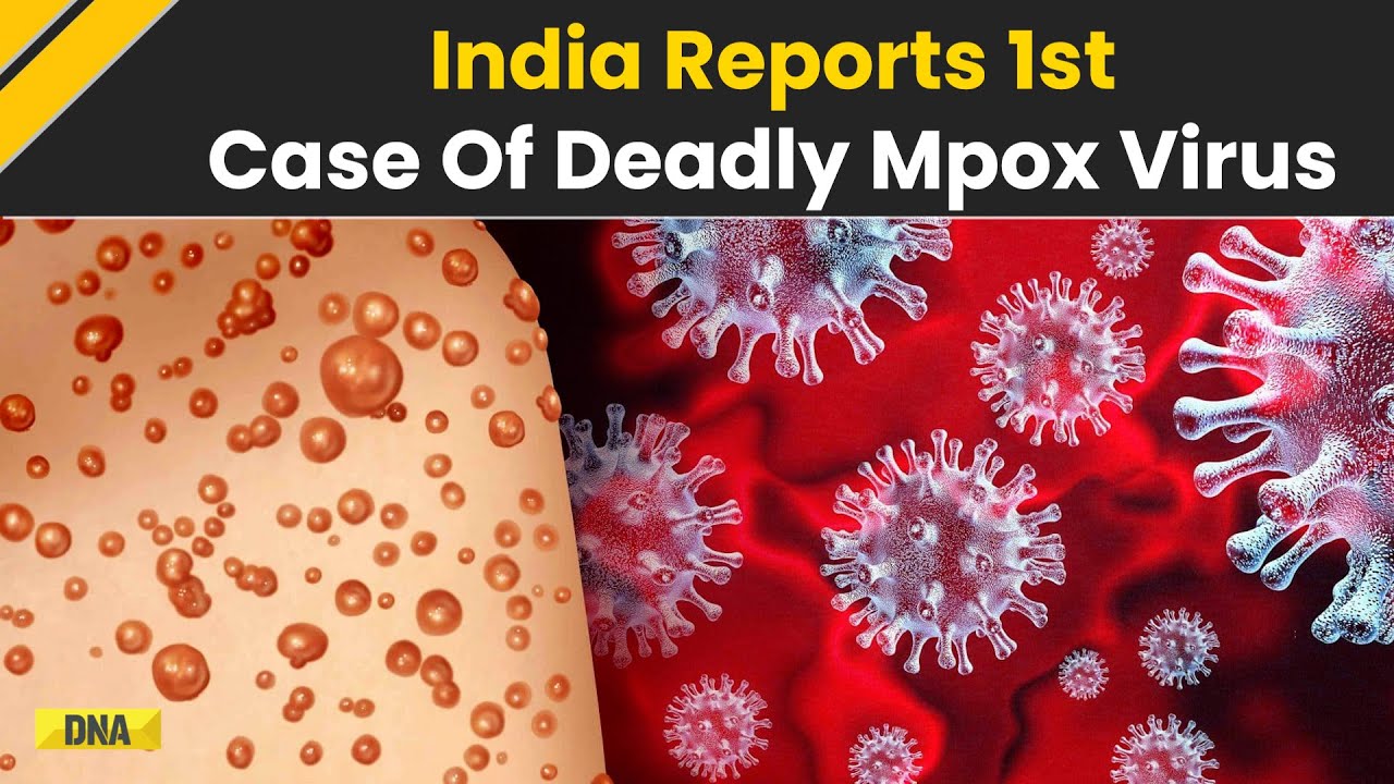 Mpox In India: First Case Of Deadly Clade 1B Variant Of Mpox Virus ...