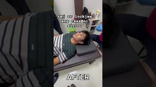 #mjhilot #chiropractor #tmj #stroke #sciatica #frozenshoulder #bonedislocation #stiffneck