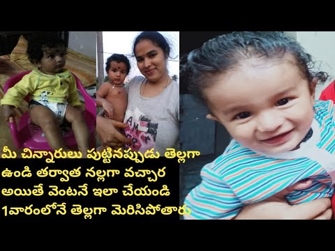 baby colour improvement tips//get fair in 1week//baby skin whitening ...