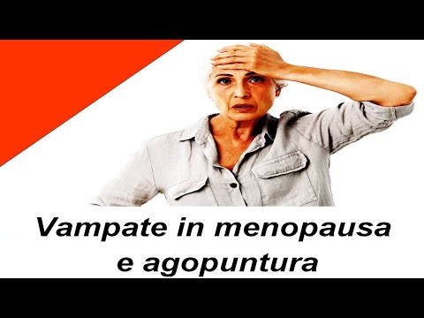 vampate in menopausa e agopuntura - acupuncture e tcm