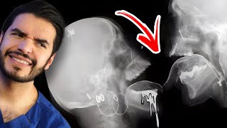 Top 10 EXPERIMENTOS CIENTÍFICOS más RAROS y RIDÍCULOS en HUMANOS | Doctor Vic