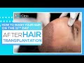 How to wash your hair on the 11th day after hair transplant operation?