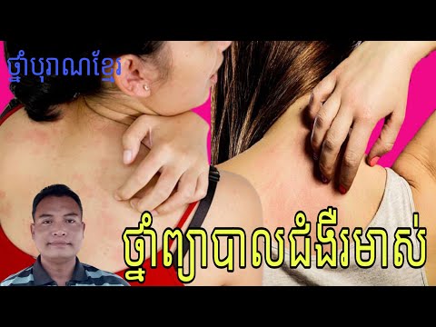 ថ្នាំបុរាណខ្មែរ : ថ្នាំព្យាបាលជំងឺរមាស់ រមាស់ដៃរមាស់ជើងរមាស់ពេញទាំងខ្លួនប្រាណ[ជំងឺរមាស់]