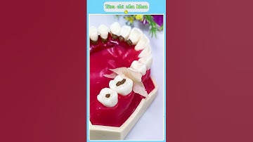 Hộp tăm chỉ tiện lợi – Gọn gàng, sạch sẽ, cực kỳ đáng tiền! 🦷✨#giadungtienich #xuhuong