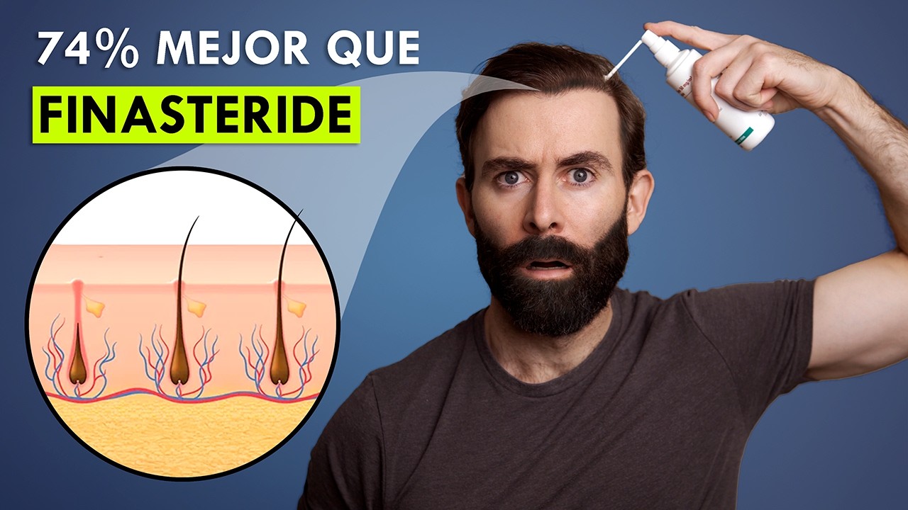 Nuevo Spray Recupera Tu Pelo En 3 Meses (74% Mejor Que Finasteride)