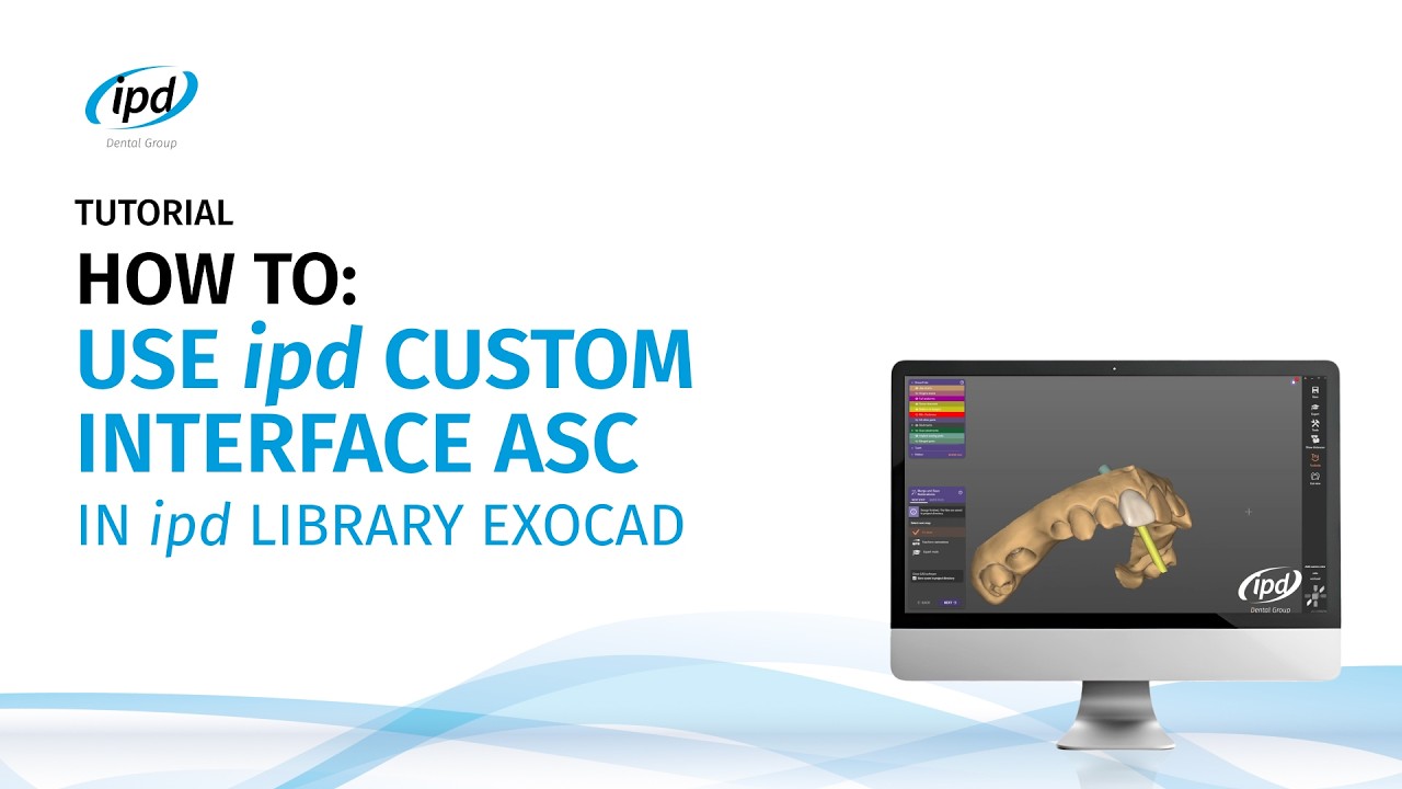 Tutorial - How to - IPD Custom Interface ASC IPD Library Exocad - YouTube