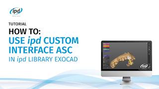 Tutorial - How to - IPD Custom Interface ASC IPD Library Exocad