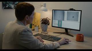 MoleMap Explained - What to expect.