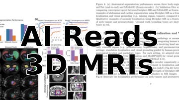 This AI Reads MRI Scans and Doctor