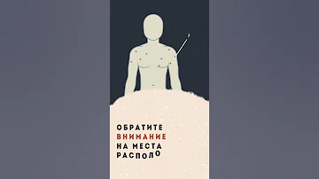 Почему появляются гемангиомы: сосудистые паучки на коже