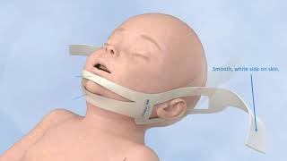 Chin Strap: Neonatal & Pediatric Neotech ChinStrap™ - Neotech Products