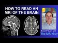 How to Read an MRI of the Brain | First Look MRI