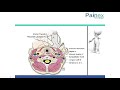 Usg guided stellate ganglion block