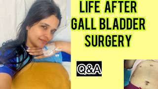 One Month Post Gallbladder Surgery ||Recovery,Diet &amp; Workout||Health update