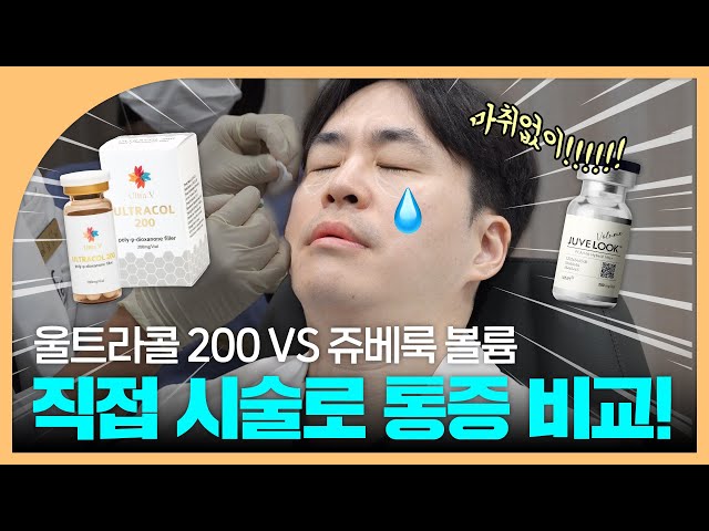 울트라콜 VS 쥬베룩 볼륨 우주 최초 반반시술 결과!｜마취없이 통증비교
