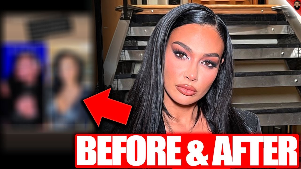 Amani's Before and After Nose Surgery Photos REVEALED! 90 Day Fiance