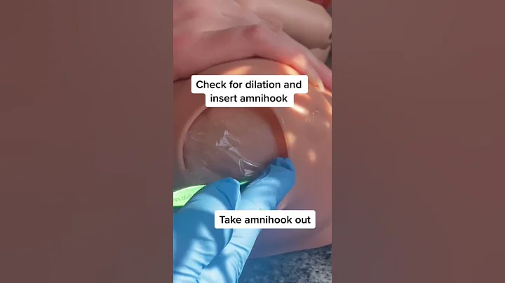 Breaking water, amniotomy