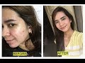 How I get rid of my ACNE (Night Skincare Routine)