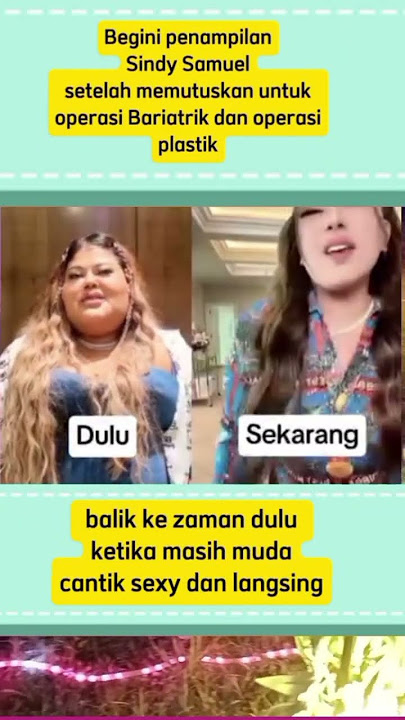 Setelah op Bariatrik dan oplas begini penampilan Shindy Samuel #shortviral #shindysamuel #artist