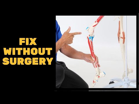 3 Tips for Knee Cartilage Problems- How to Fix Without Surgery + Giveaway!