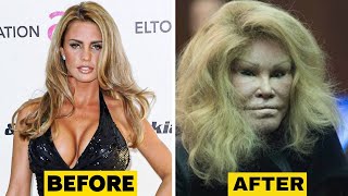 People Who Have Taken Plastic Surgery To New Heights
