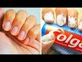 20 einfache Tricks für perfekte Fingernägel