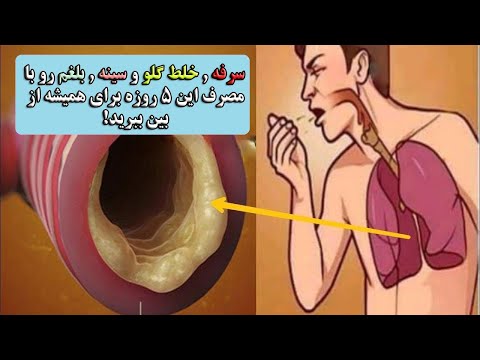 سرفه , خلط گلو و سینه , بلغم رو با مصرف این 5 روزه برای همیشه از بین ببرید!