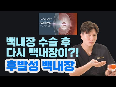 [Ариун Эх Жин Нүдний Эмнэлэг] Болор цайх мэс заслын дараах гаж нөлөөний талаарх буруу ойлголт ба үнэн ✨ [Жинхэнэ Нүдний Эмнэлэг] [3 минутын Нүдний Эмнэлэг] ⏰