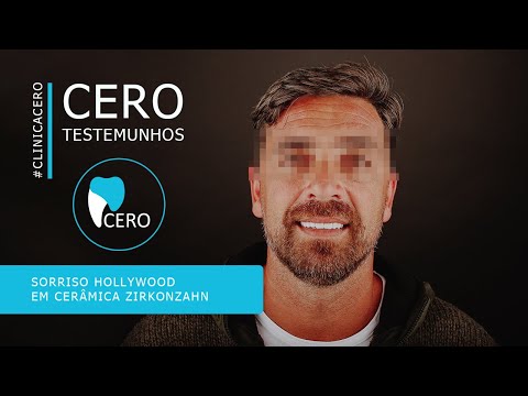 Testemunho Beto - Sorriso Hollywood em cerâmica Zirkonzahn