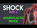 Understanding Distributive Shock and Anaphylactic Shock