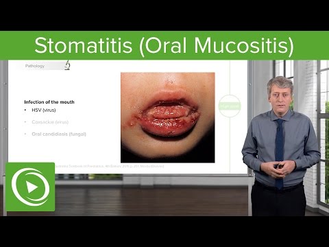 سٹومیٹائٹس (اورل میوکوسائٹس) - بچوں کی متعدی بیماریاں | لیکچریو