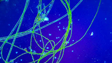 Rheinberg Illumination Microscopy