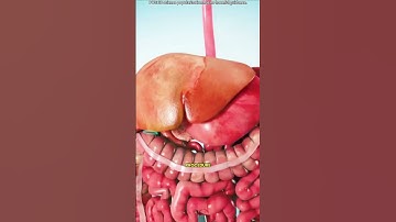 Gallbladder removal surgery 3D animation (cholecystectomy)