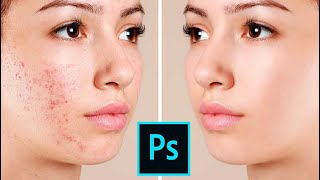★ COMO LIMPIAR LA PIEL DE IMPERFECCIONES EN PHOTOSHOP - 2021 screenshot 4