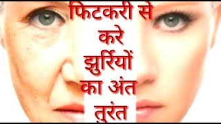 Fitkari फिटकरी से करे झुर्रिया को अंत तुरंत |Fitkari ke fayde (Alum)