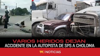 Download Lagu Varios heridos dejan accidente en la autopista de San Pedro Sula a Choloma MP3
