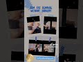 Achieve Toned Arms with IceFiT Studio Med Spa's Armpit Fat Reduction Treatment