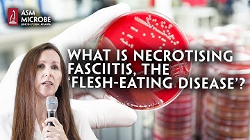 What Is Necrotising Fasciitis, The ‘Flesh-Eating Disease’?