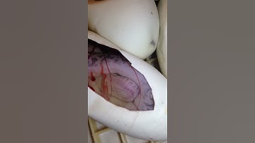 Ball Python moving inside egg!