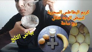 ماسك البطاطس والحليب خلطةسحرية لتبيض الوجه خلال ربع ساعة|samira el yaagoubi