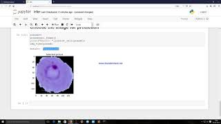 Malaria Cell Detection | Pranab Sarkar | Deep Learning