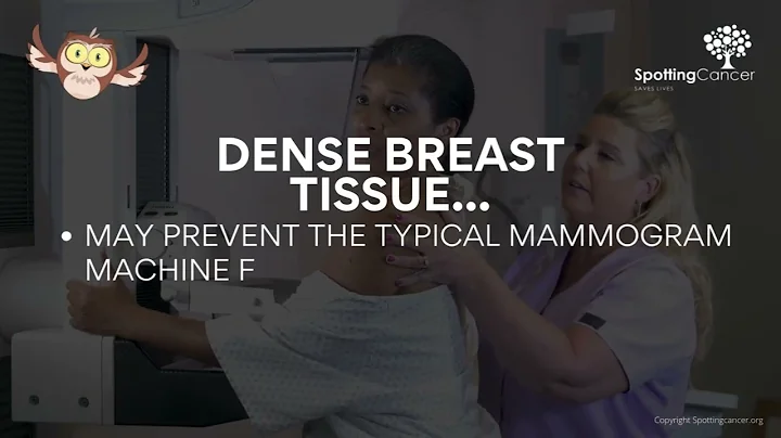 New FDA Rules Change How You Get Mammogram Results