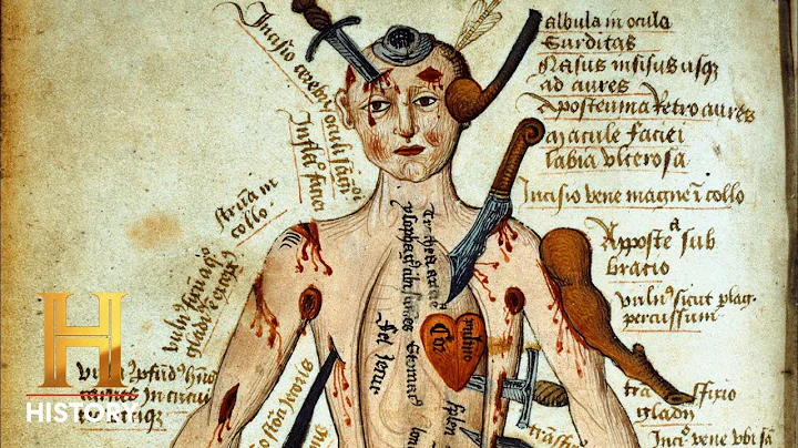 How a Gruesome Epidemic Threatened the Roman Empire | Colosseum | History