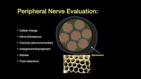 Dr. Jeimylo de Castro talks about MSK ultrasound of the upper extremity peripheral nerves