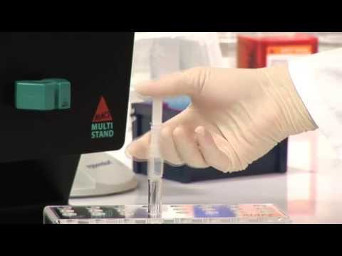 ასტროციტების გამოყოფა ტვინის ქსოვილიდან