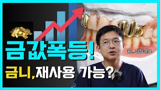 금니는 재사용이 될까? 치과에 골드를 달라고해도 될까?