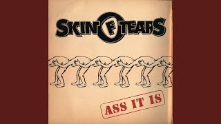 Watch Skin Of Tears Shut Up video