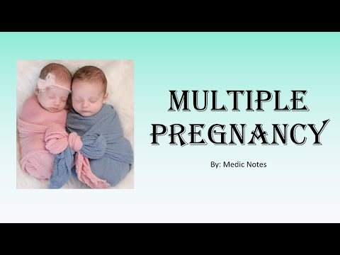 [O&G] Multiple pregnancy, twins, triplets - risk factor, antenatal & labor management, complications