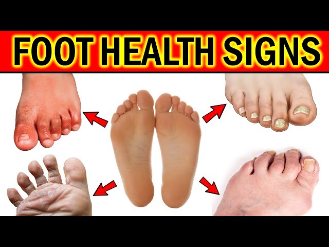 What your feet can reveal about the state of your health - and when to  worry