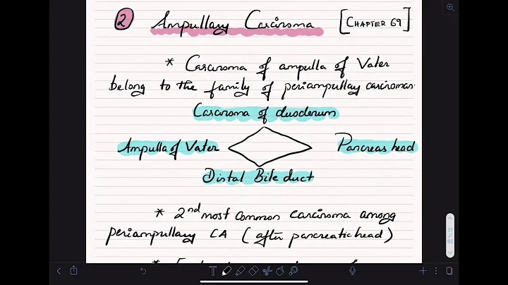 Ampullary Carcinoma - Medical Gastroenterology (Sl...